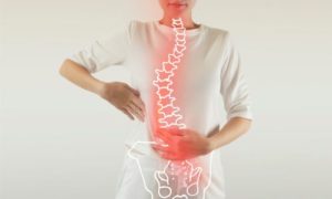 ぎっくり腰による突発的な側弯