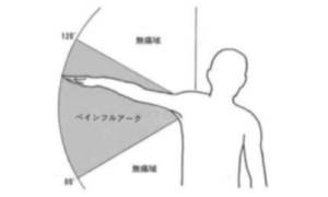 ペインフルアークサイン