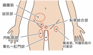 グロインペインの説明