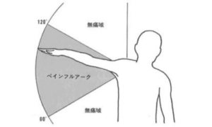 腱板損傷の整形外科テスト