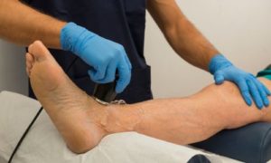 足の超音波治療