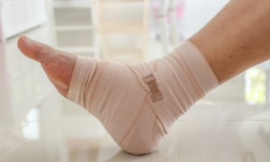 足関節捻挫後に固定が長引くと後遺症が残りやすい