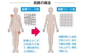 筋膜は全身繋がっている